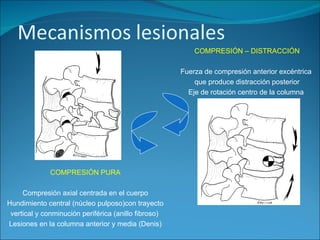 COMPRESIÓN PURA Compresión axial centrada en el cuerpo Hundimiento central (núcleo pulposo)con trayecto vertical y conminución periférica (anillo fibroso)   Lesiones en la columna anterior y media (Denis) COMPRESIÓN – DISTRACCIÓN Fuerza de compresión anterior excéntrica  que produce distracción posterior Eje de rotación centro de la columna  