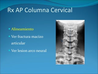 Rx AP Columna Cervical Alineamiento   Ver fractura macizo articular Ver lesion arco neural 