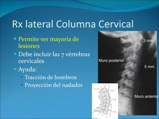 Rx lateral Columna Cervical Permite ver mayoria de  lesiones  Debe incluir las 7 vértebras cervicales  Ayuda: Tracción de hombros Proyección del nadador Muro posterior 3 mm 5 mm Muro anterior 