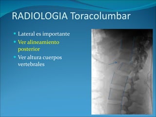 RADIOLOGIA Toracolumbar Lateral es importante Ver alineamiento posterior Ver altura cuerpos vertebrales 