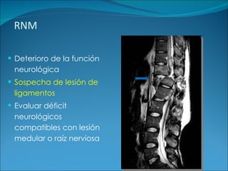 RNM Deterioro de la función neurológica  Sospecha de lesión de ligamentos Evaluar déficit neurológicos compatibles con lesión medular o raíz nerviosa 