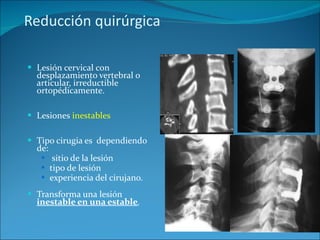 Reducción quirúrgica   Lesión cervical con desplazamiento vertebral o articular, irreductible ortopédicamente. Lesiones  inestables Tipo cirugia es  dependiendo de: sitio de la lesión tipo de lesión experiencia del cirujano. Transforma una lesión  inestable en una estable . 