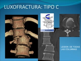 LESION  DE TODAS  LAS COLUMNAS 