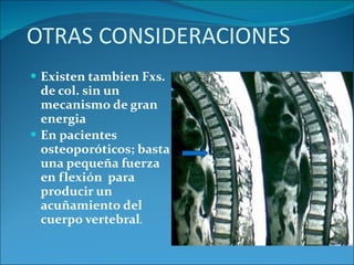 OTRAS CONSIDERACIONES Existen tambien Fxs. de col. sin un mecanismo de gran energia En pacientes osteoporóticos; basta una pequeña fuerza en flexión  para producir un acuñamiento del cuerpo vertebral . 