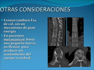 OTRAS CONSIDERACIONES Existen tambien Fxs. de col. sin un mecanismo de gran energia En pacientes  metastasicos ; basta una pequeña fuerza en flexión  para producir un acuñamiento del cuerpo vertebral . 