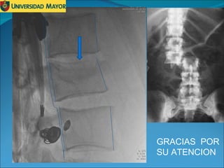 GRACIAS  POR  SU ATENCION 