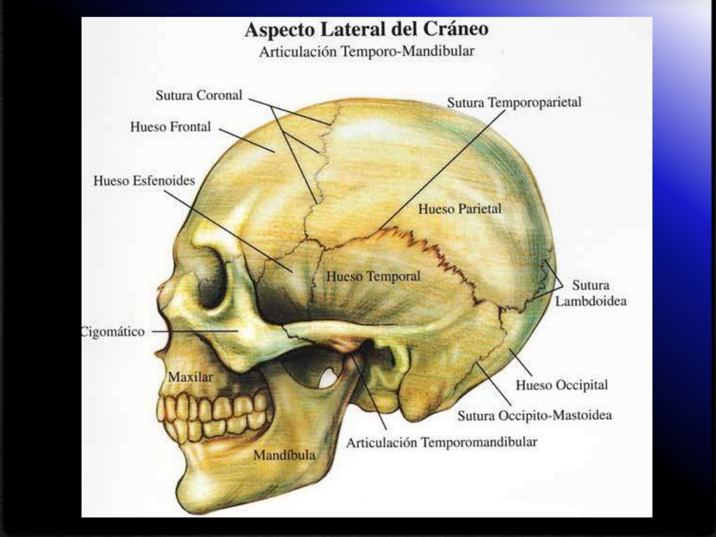 Fracturas de craneo Fracturas de craneo