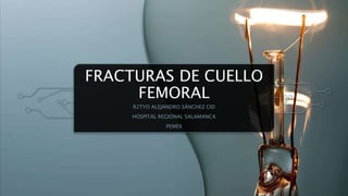 FRACTURAS DE CUELLO
FEMORAL
R2TYO ALEJANDRO SÁNCHEZ CID
HOSPITAL REGIONAL SALAMANCA
PEMEX
 