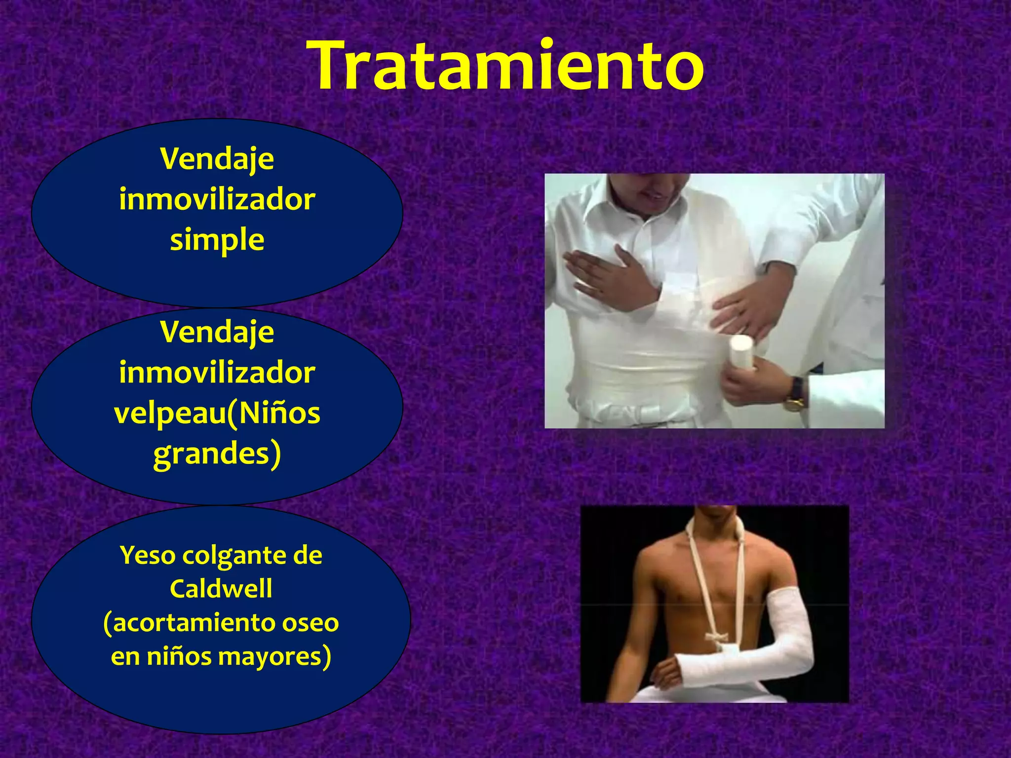 fracturas-de-diafisis-del-humero-pptx-first-aid-injuries