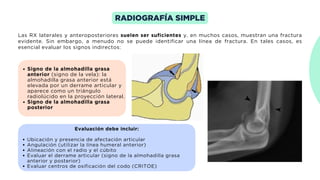 Comprehensive Overview of Proximal Upper Limb Fractures and ...