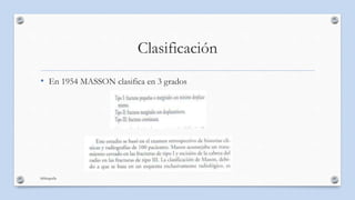 Clasificación
• En 1954 MASSON clasifica en 3 grados
bibliografia
 