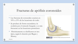 Fracturas de apófisis coronoides
• Las fracturas de coronoides ocurren en
10% a 15% de las luxaciones de codo.
• Se produc...
