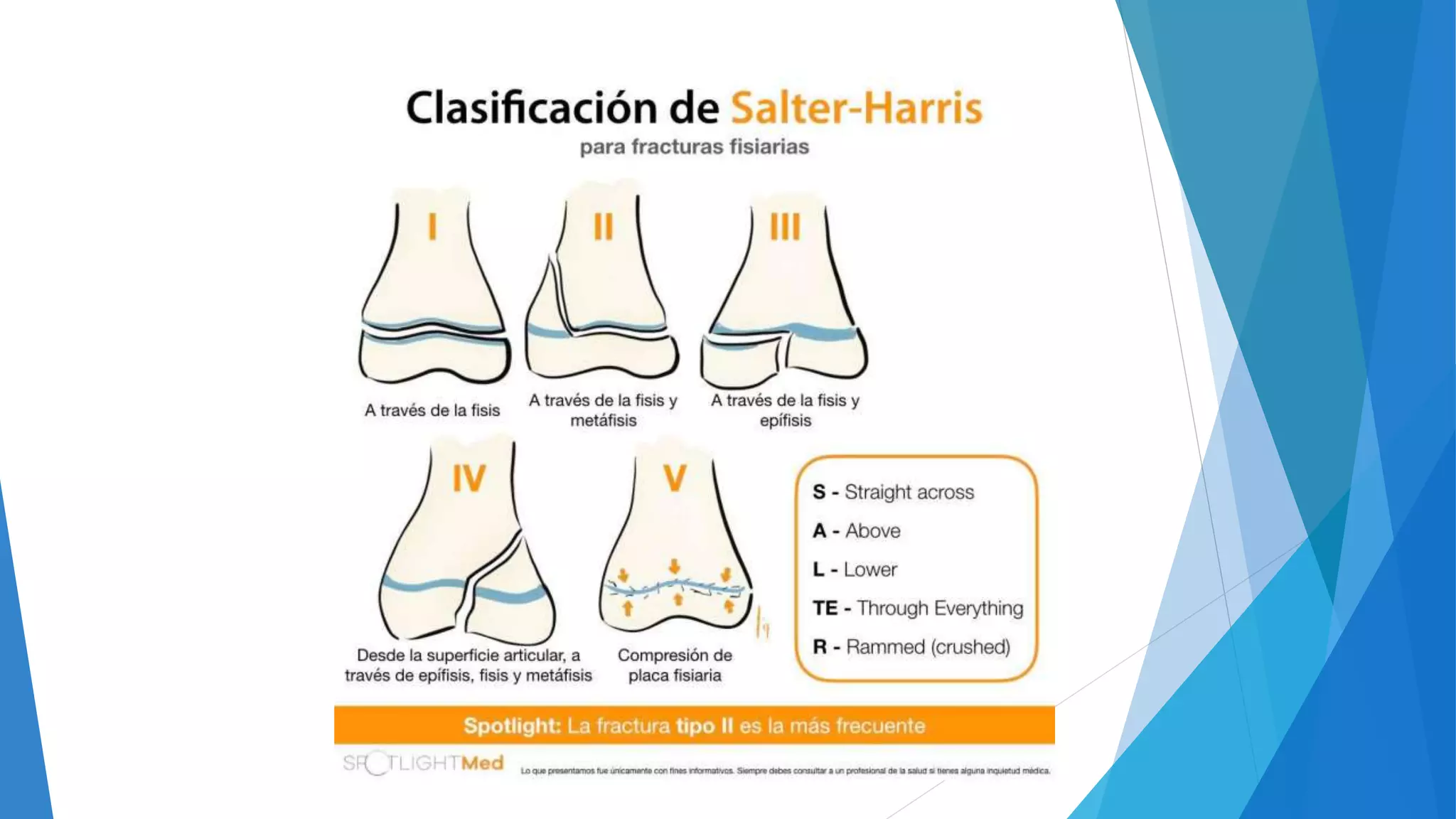FRACTURAS DE FEMUR DISTAL.pptx