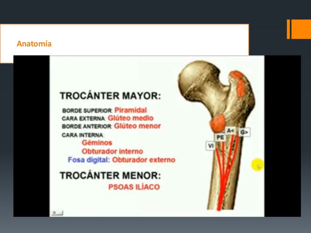 Fracturas De Femur Proximal