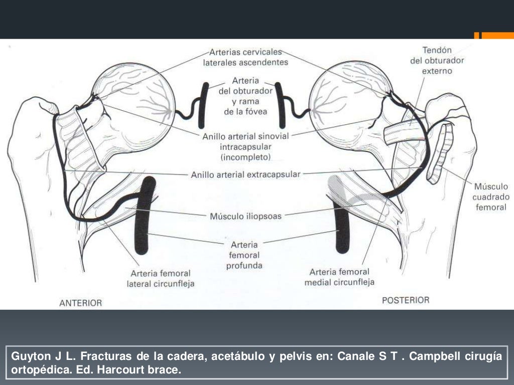 Fracturas De Femur Proximal Fracturas De Femur Proximal
