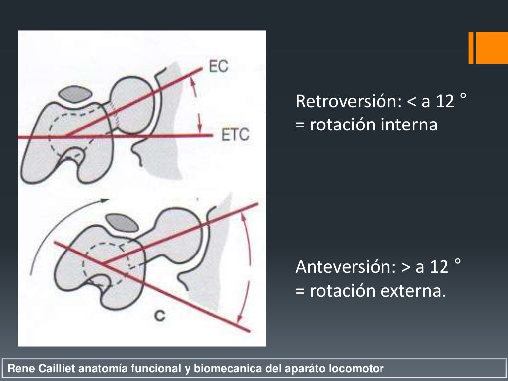 Fracturas De Femur Proximal Fracturas De Femur Proximal