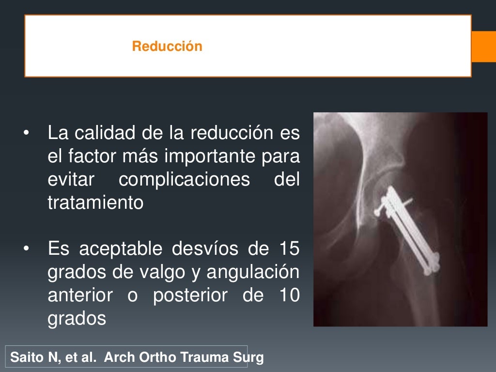 Fracturas De Femur Proximal