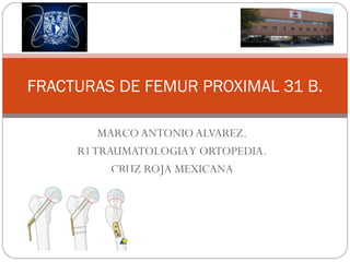 FRACTURAS DE FEMUR PROXIMAL 31 B. 
MARCO ANTONIO ALVAREZ. 
R1 TRAUMATOLOGIA Y ORTOPEDIA. 
CRUZ ROJA MEXICANA 
 