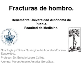 Fracturas de hombro.
Benemérita Universidad Autónoma de
Puebla.
Facultad de Medicina.
Nosología y Clínica Quirúrgica del Aparato Músculo-
Esquelético.
Profesor: Dr. Eulogio López Calixto.
Alumno: Marco Antonio Amador González.
 