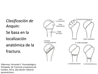 Clasificación de
Anquin:
Se basa en la
localización
anatómica de la
fractura.
Silberman, Fernando S. Traumatología y
Ortopedia. 50. Fracturas y luxaciones de
hombro. 337 p. 2da edición. Editorial
panamericana.
 