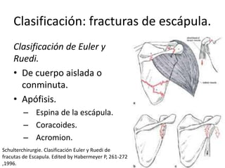 Clasificación: fracturas de escápula.
Clasificación de Euler y
Ruedi.
• De cuerpo aislada o
conminuta.
• Apófisis.
– Espina de la escápula.
– Coracoides.
– Acromion.
Schulterchirurgie. Clasificación Euler y Ruedi de
fracutas de Escapula. Edited by Habermeyer P, 261-272
,1996.
 