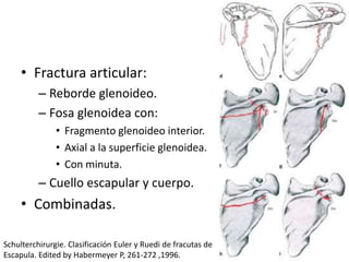 • Fractura articular:
– Reborde glenoideo.
– Fosa glenoidea con:
• Fragmento glenoideo interior.
• Axial a la superficie glenoidea.
• Con minuta.
– Cuello escapular y cuerpo.
• Combinadas.
Schulterchirurgie. Clasificación Euler y Ruedi de fracutas de
Escapula. Edited by Habermeyer P, 261-272 ,1996.
 