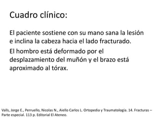 Cuadro clínico:
El paciente sostiene con su mano sana la lesión
e inclina la cabeza hacia el lado fracturado.
El hombro está deformado por el
desplazamiento del muñón y el brazo está
aproximado al tórax.
Valls, Jorge E., Perruello, Nicolas N., Aiello Carlos L. Ortopedia y Traumatología. 14. Fracturas –
Parte especial. 113 p. Editorial El Ateneo.
 