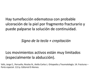 Hay tumefacción edematosa con probable
ulceración de la piel por fragmento fracturario y
puede palparse la solución de continuidad.
Signo de la tecla + crepitación
Los movimientos activos están muy limitados
(especialmente la abducción).
Valls, Jorge E., Perruello, Nicolas N., Aiello Carlos L. Ortopedia y Traumatología. 14. Fracturas –
Parte especial. 113 p. Editorial El Ateneo.
 