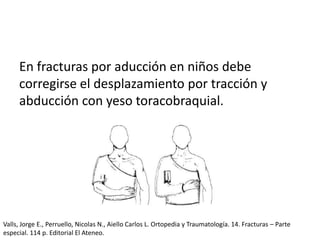 En fracturas por aducción en niños debe
corregirse el desplazamiento por tracción y
abducción con yeso toracobraquial.
Valls, Jorge E., Perruello, Nicolas N., Aiello Carlos L. Ortopedia y Traumatología. 14. Fracturas – Parte
especial. 114 p. Editorial El Ateneo.
 