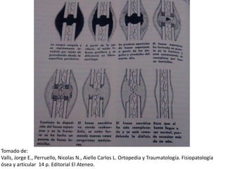 Tomado de:
Valls, Jorge E., Perruello, Nicolas N., Aiello Carlos L. Ortopedia y Traumatología. Fisiopatología
ósea y articular 14 p. Editorial El Ateneo.
 