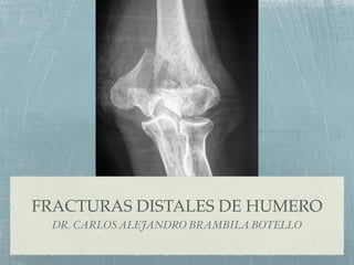 FRACTURAS DISTALES DE HUMERO
 DR. CARLOS ALEJANDRO BRAMBILA BOTELLO
 