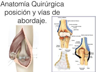 Anatomía Quirúrgica
 posición y vías de
     abordaje.
 