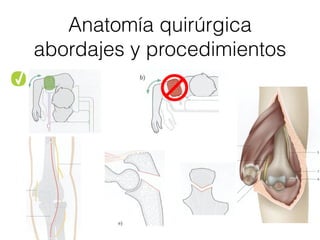 Anatomía quirúrgica
abordajes y procedimientos
 
