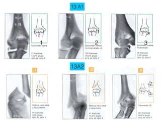 13 A1




1           2   3



    13A2
 