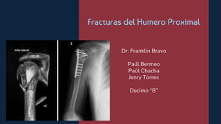 Fracturas del Humero Proximal
Dr. Franklin Bravo
Paúl Bermeo
Paúl Chacha
Jenry Torres
Decimo “B”
 