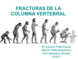 FRACTURAS DE LA COLUMNA VERTEBRAL Mª Carmen Prieto Falcón MIR R1 Radiodiagnóstico HUV Macarena (Sevilla) 15/3/11 