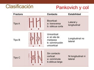 Clasificación <br />Pankovich y col<br />