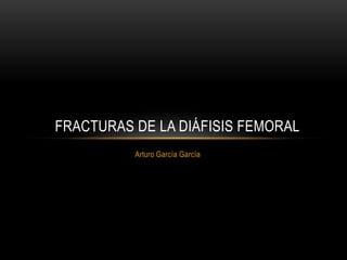 Arturo García García
FRACTURAS DE LA DIÁFISIS FEMORAL
 