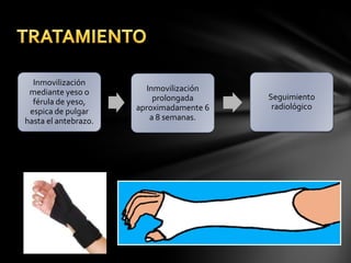 Inmovilización
 mediante yeso o         Inmovilización
                           prolongada     Seguimiento
  férula de yeso,
                      aproximadamente 6    radiológico
 espica de pulgar
hasta el antebrazo.       a 8 semanas.
 