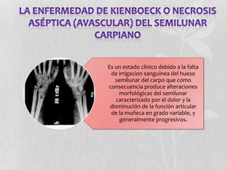 Es un estado clínico debido a la falta
 de irrigacion sanguínea del hueso
   semilunar del carpo que como
consecuencia produce alteraciones
    morfológicas del semilunar
   caracterizado por el dolor y la
 disminución de la función articular
 de la muñeca en grado variable, y
    generalmente progresivos.
 