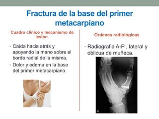 Fractura de la base del primer
               metacarpiano
Cuadro clinico y mecanismo de
            lesion.                 Ordenes radiológicas

• Caída hacia atrás y           • Radiografia A-P , lateral y
  apoyando la mano sobre el      oblicua de muñeca.
  borde radial de la misma.
• Dolor y edema en la base
  del primer metacarpiano.
 