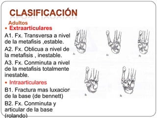 Adultos
 Extraarticulares
A1. Fx. Transversa a nivel
de la metafisis ,estable.
A2. Fx. Oblicua a nivel de
la metafisis , inestable.
A3. Fx. Conminuta a nivel
de la metafisis totalmente
inestable.
 Intraarticulares
B1. Fractura mas luxacion
de la base (de bennett)
B2. Fx. Conminuta y
articular de la base
(rolando)
 