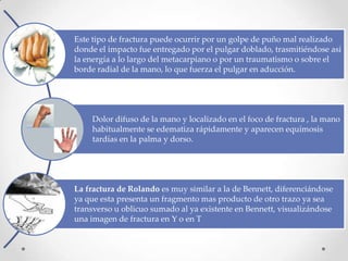 Este tipo de fractura puede ocurrir por un golpe de puño mal realizado
donde el impacto fue entregado por el pulgar doblado, trasmitiéndose así
la energía a lo largo del metacarpiano o por un traumatismo o sobre el
borde radial de la mano, lo que fuerza el pulgar en aducción.




    Dolor difuso de la mano y localizado en el foco de fractura , la mano
    habitualmente se edematiza rápidamente y aparecen equímosis
    tardías en la palma y dorso.




La fractura de Rolando es muy similar a la de Bennett, diferenciándose
ya que esta presenta un fragmento mas producto de otro trazo ya sea
transverso u oblicuo sumado al ya existente en Bennett, visualizándose
una imagen de fractura en Y o en T
 
