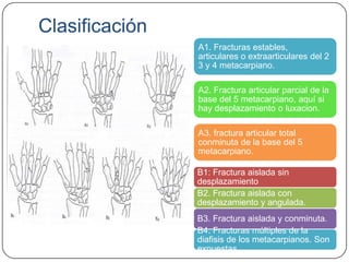 Clasificación
                A1. Fracturas estables,
                articulares o extraarticulares del 2
                3 y 4 metacarpiano.

                A2. Fractura articular parcial de la
                base del 5 metacarpiano, aquí si
                hay desplazamiento o luxacion.

                A3. fractura articular total
                conminuta de la base del 5
                metacarpiano.

                B1: Fractura aislada sin
                desplazamiento
                B2. Fractura aislada con
                desplazamiento y angulada.
                B3. Fractura aislada y conminuta.
                B4. Fracturas múltiples de la
                diafisis de los metacarpianos. Son
                expuestas.
 