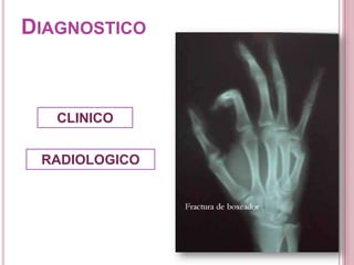 DIAGNOSTICO



   CLINICO


 RADIOLOGICO
 
