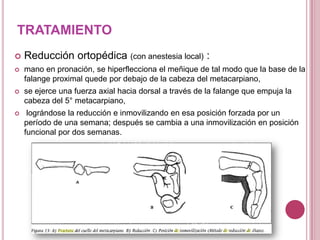 TRATAMIENTO
   Reducción ortopédica (con anestesia local) :
   mano en pronación, se hiperflecciona el meñique de tal modo que la base de la
    falange proximal quede por debajo de la cabeza del metacarpiano,
   se ejerce una fuerza axial hacia dorsal a través de la falange que empuja la
    cabeza del 5° metacarpiano,
    lográndose la reducción e inmovilizando en esa posición forzada por un
    período de una semana; después se cambia a una inmovilización en posición
    funcional por dos semanas.
 