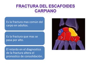 Es la fractura mas común del
carpo en adultos.


Es la fractura que mas se
pasa por alto.

El retardo en el diagnostico
de la fractura altera el
pronostico de consolidación.
 
