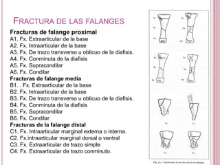 FRACTURA DE LAS FALANGES
Fracturas de falange proximal
A1. Fx. Extraarticular de la base
A2. Fx. Intraarticular de la base
A3. Fx. De trazo transverso u oblicuo de la diafisis.
A4. Fx. Conminuta de la diafisis
A5. Fx. Supracondilar
A6. Fx. Condilar
Fracturas de falange media
B1. . Fx. Extraarticular de la base
B2. Fx. Intraarticular de la base
B3. Fx. De trazo transverso u oblicuo de la diafisis.
B4. Fx. Conminuta de la diafisis
B5. Fx. Supracondilar
B6. Fx. Condilar
Fracturas de la falange distal
C1. Fx. Intraarticular marginal externa o interna.
C2. Fx.intraarticular marginal dorsal o ventral
C3. Fx. Extraarticular de trazo simple
C4. Fx. Estraarticular de trazo conminuto.
 