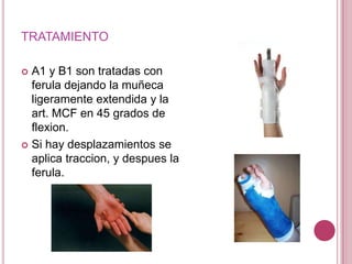 TRATAMIENTO

 A1 y B1 son tratadas con
  ferula dejando la muñeca
  ligeramente extendida y la
  art. MCF en 45 grados de
  flexion.
 Si hay desplazamientos se
  aplica traccion, y despues la
  ferula.
 