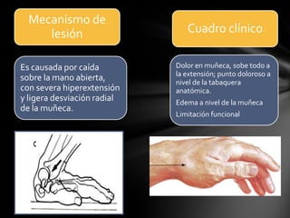 Mecanismo de
     lesión                     Cuadro clínico

Es causada por caída         Dolor en muñeca, sobe todo a
                             la extensión; punto doloroso a
sobre la mano abierta,       nivel de la tabaquera
con severa hiperextensión    anatómica.
y ligera desviación radial   Edema a nivel de la muñeca
de la muñeca.
                             Limitación funcional
 